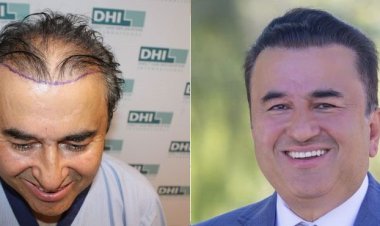 Why is India a Growing Hair Transplant Destination?